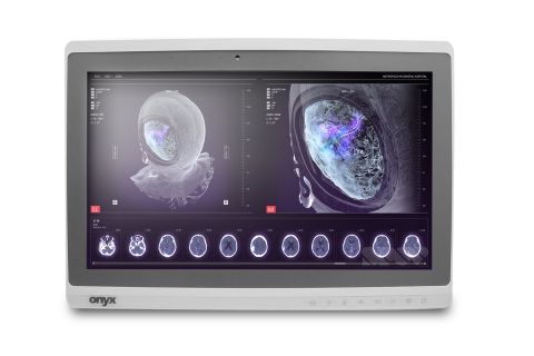 REGLOO ONYX PC AIO 2121DTT ATOM D525/6/SSD240/W10PMAR/2Y